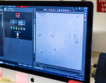 Closeup of a computer screen showing a microscopic view